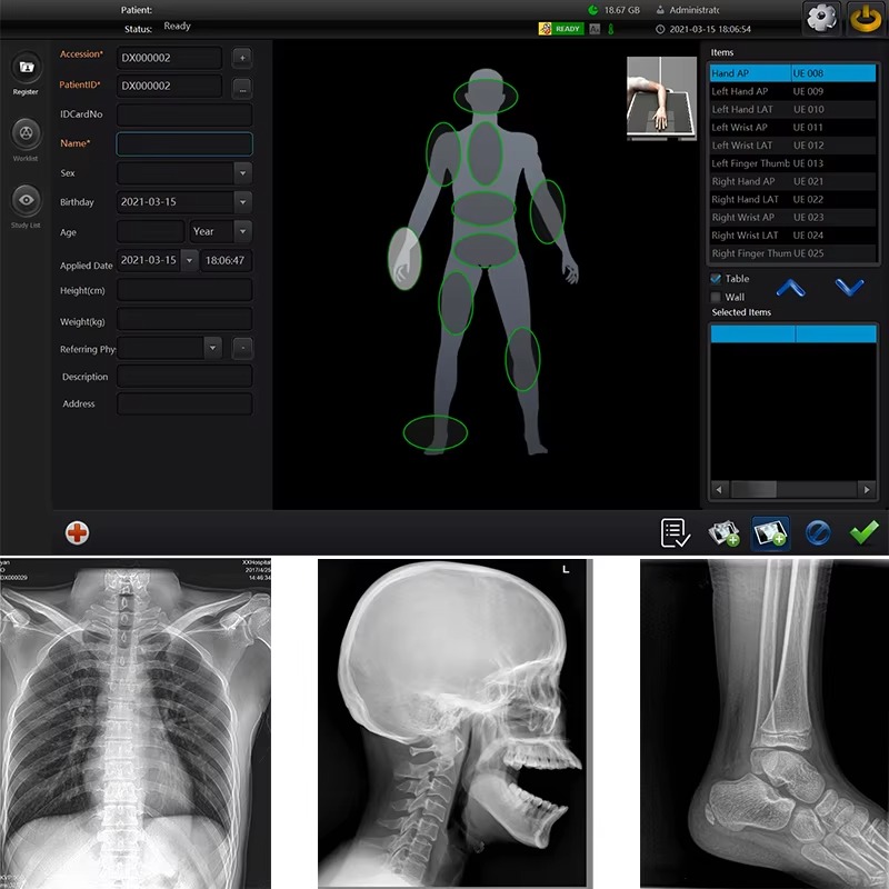 Wired / Wireless Flat Panel Detector BX3543Z X-ray Detector