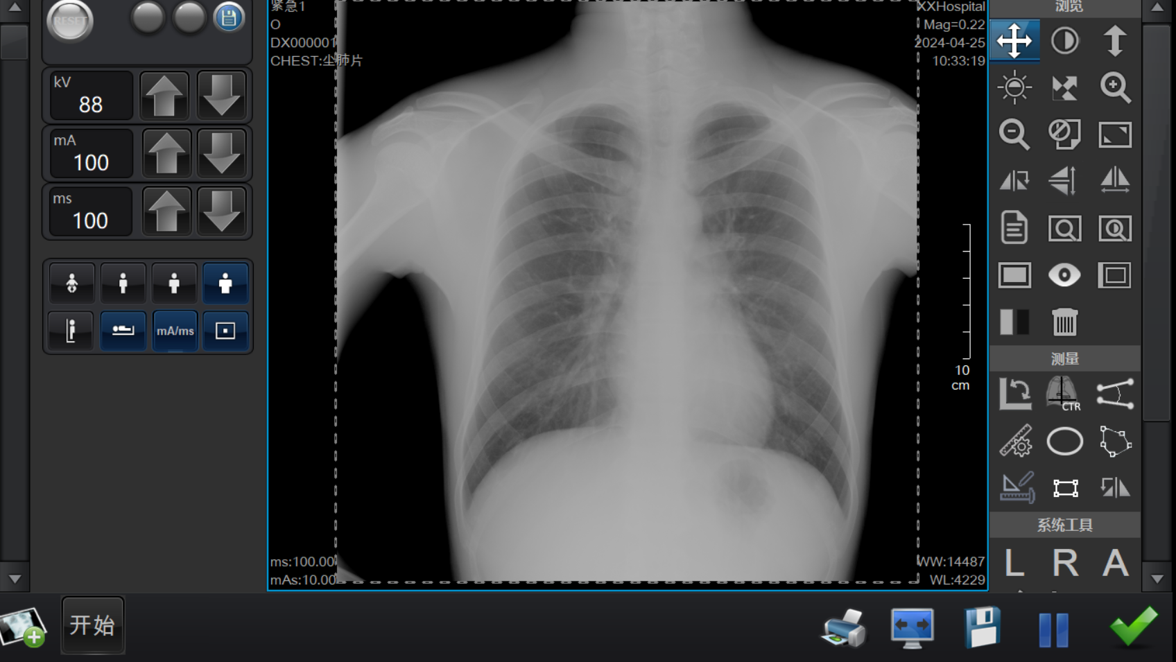 1717in Flat Panel Detector (Wired & Wireless) BX1717FPD