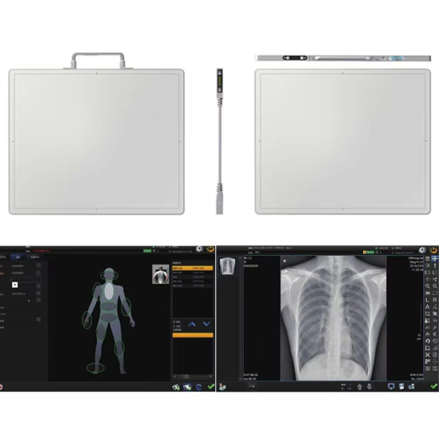 Wired / Wireless Flat Panel Detector BX4343Z X-ray Detector