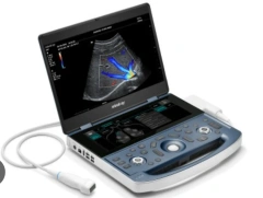 BEST SELLER Mindray MX7 Dedicated Portable Ultrrasound System New in stock