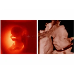 Medical Ultrasound Instruments Mindray Z50 Portable Color Doppler 3D 4D Ultrasound System Scanner Digital Ultrasound