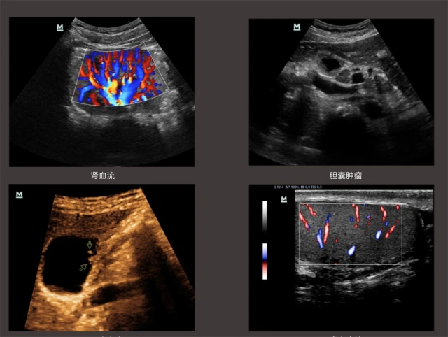 Mindray DC-N3S Trolley Ultrasound Doppler Machine