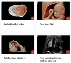 Mindray DC-70 USG Machine Medical Ultrasound Instruments Mindray DC 70 Ultrasound Machine With Trolley