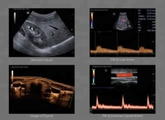 Mindray 4D Color Doppler Ultrasound Machine DC-40 With CW Module and 4D Module