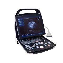 Portable Full Digital Ultrasound Device Original Mindray DP-30 BW Mindray DP 30 Ultrasound Machine
