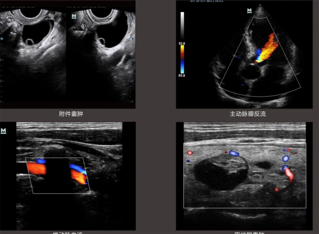 Mindray DC-N3S Trolley Ultrasound Doppler Machine