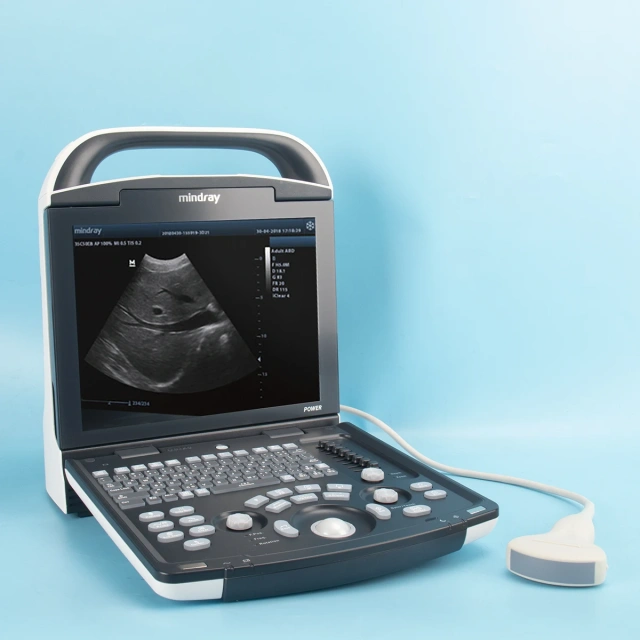 Mindray Portable Medical Ultrasonido Mindray Ultrasound Machine Mindray Dp 20 Ultrasound Machine