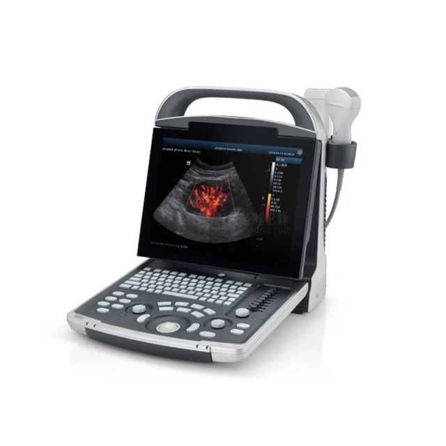 Portable Full Digital Ultrasound Device Original Mindray DP-30 BW Mindray DP 30 Ultrasound Machine