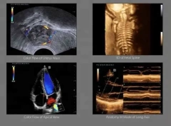 Mindray 4D Color Doppler Ultrasound Machine DC-40 With CW Module and 4D Module