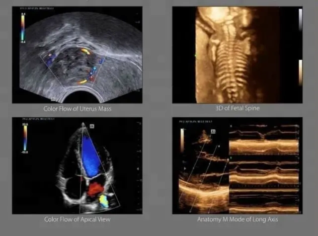 Mindray 4D Color Doppler Ultrasound Machine DC-40 With CW Module and 4D Module
