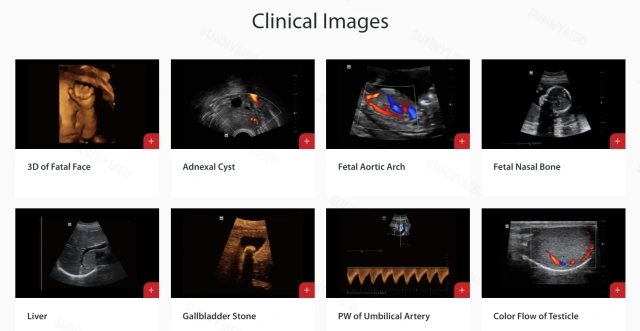 Medical Ultrasound Instruments Mindray Z50 Portable Color Doppler 3D 4D Ultrasound System Scanner Digital Ultrasound