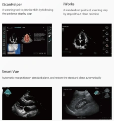 Mindray Consona N6 N7 N8 N9 Color Doppler Ultrasound Cardiovascular Obstetrics Gynecology Urology USG Machine