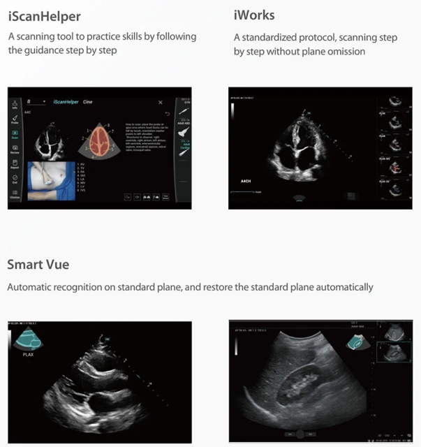 Mindray Consona N6 N7 N8 N9 Color Doppler Ultrasound Cardiovascular Obstetrics Gynecology Urology USG Machine