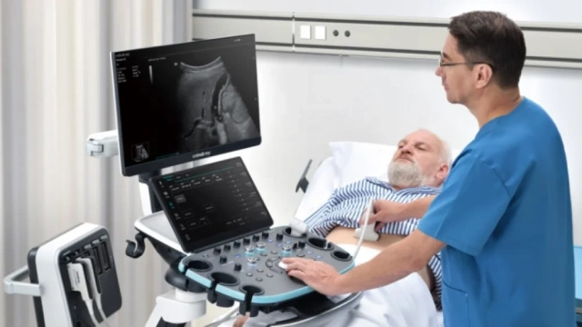 China Best-quality Color Trolley Ultrasound Machine Resona I9 R9 7 Diagnostic Ultrasound System for Clinic