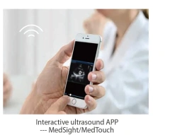 High Quality Mindray DC-60 Diagnostic Ultrasound System for Hospital Use