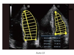 High Quality Mindray DC-60 Diagnostic Ultrasound System for Hospital Use