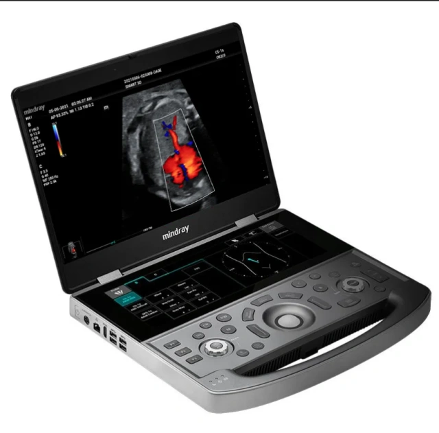 BEST SELLER Mindray MX7 Dedicated Portable Ultrrasound System New in stock