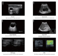 Mindray Consona N6 N7 N8 N9 Color Doppler Ultrasound Cardiovascular Obstetrics Gynecology Urology USG Machine