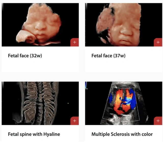 Mindray DC-70 USG Machine Medical Ultrasound Instruments Mindray DC 70 Ultrasound Machine With Trolley