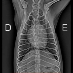 Best Iray Mars 1417V X Ray Medical Digital Dr Wireless Digital Flat Panel Detector for Hospital