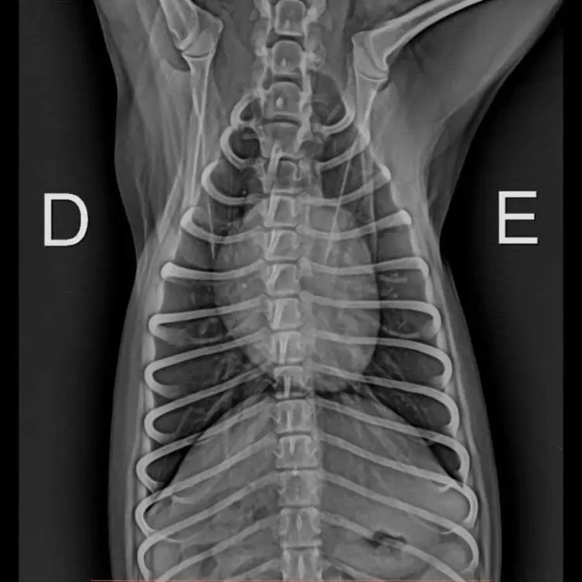 Best Iray Mars 1417V X Ray Medical Digital Dr Wireless Digital Flat Panel Detector for Hospital