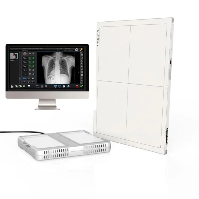 Best Iray Mars 1417V X Ray Medical Digital Dr Wireless Digital Flat Panel Detector for Hospital