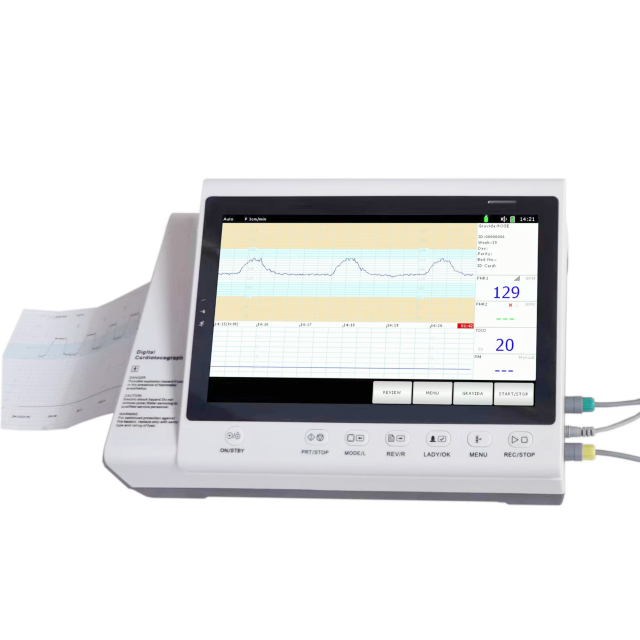 Fetal Monitor