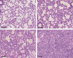 肺纤维化（Pulmonary Fibrosis）模型