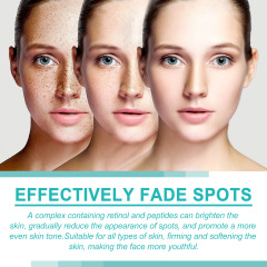 Facial skin cream Black freckles and acne faded black spots removal whitening cream