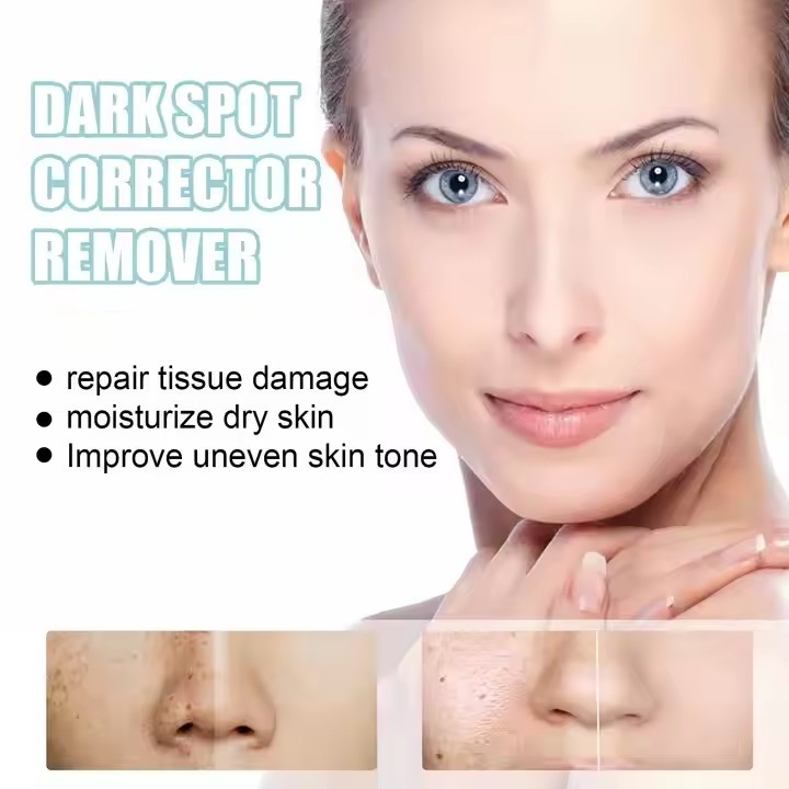 Facial skin cream Black freckles and acne faded black spots removal whitening cream
