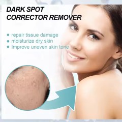 Facial skin cream Black freckles and acne faded black spots removal whitening cream