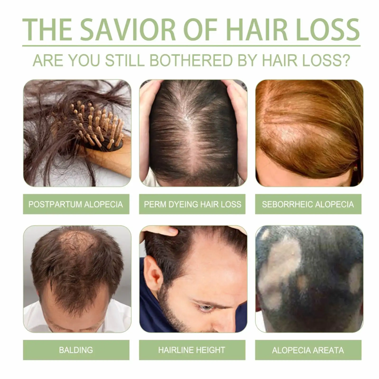 Strong and dense hair prevents strong hair cleansing scalp repair soft hair care oil