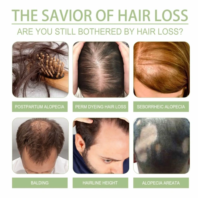 Strong and dense hair prevents strong hair cleansing scalp repair soft hair care oil