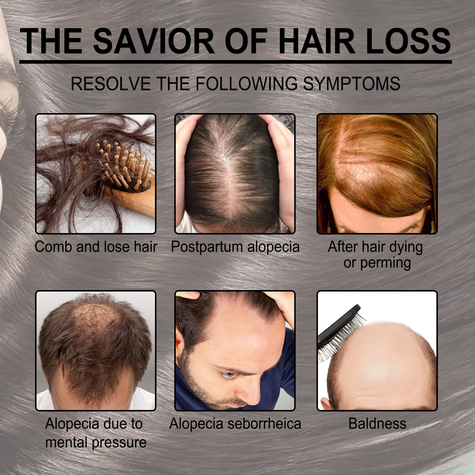 Rosemary Essentiall Oil Hair Growth Products Organic Products Scalp Hair Strengthening Oil For Nourish Shiny Healthy