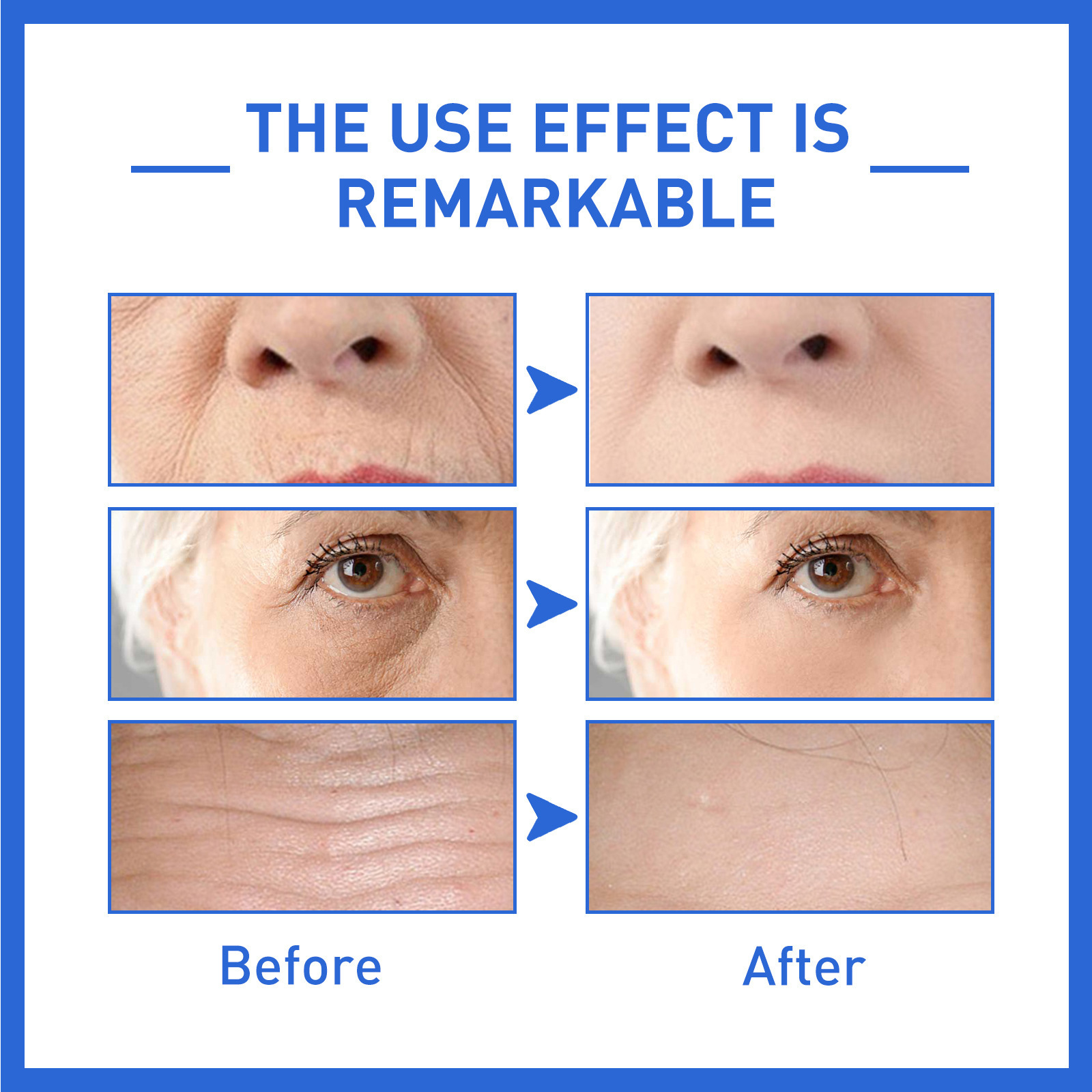 Collagen Facial Essence Lightens Fine Wrinkles Nasolabial Firming Moisturizing