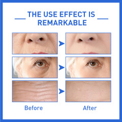 Collagen Facial Essence Lightens Fine Wrinkles Nasolabial Firming Moisturizing