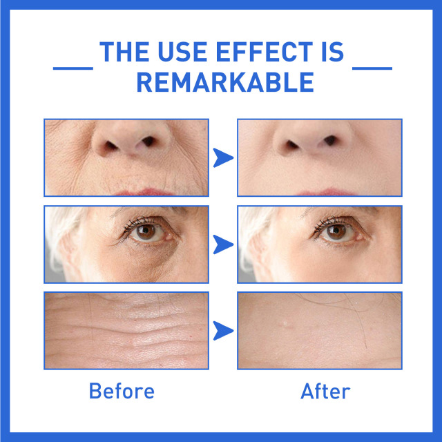 Collagen Facial Essence Lightens Fine Wrinkles Nasolabial Firming Moisturizing