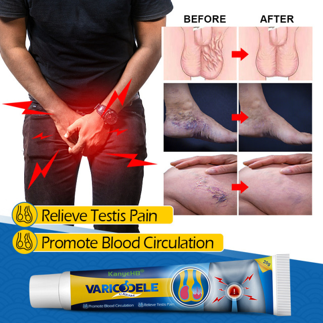 Men's private part Quzhang cream Maikang cream Earthworm leg vein cream