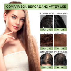 OUHOE Herbal hair oil