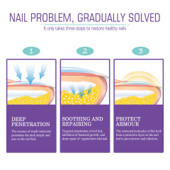 Jaysuing Onychomycosis Care Spray