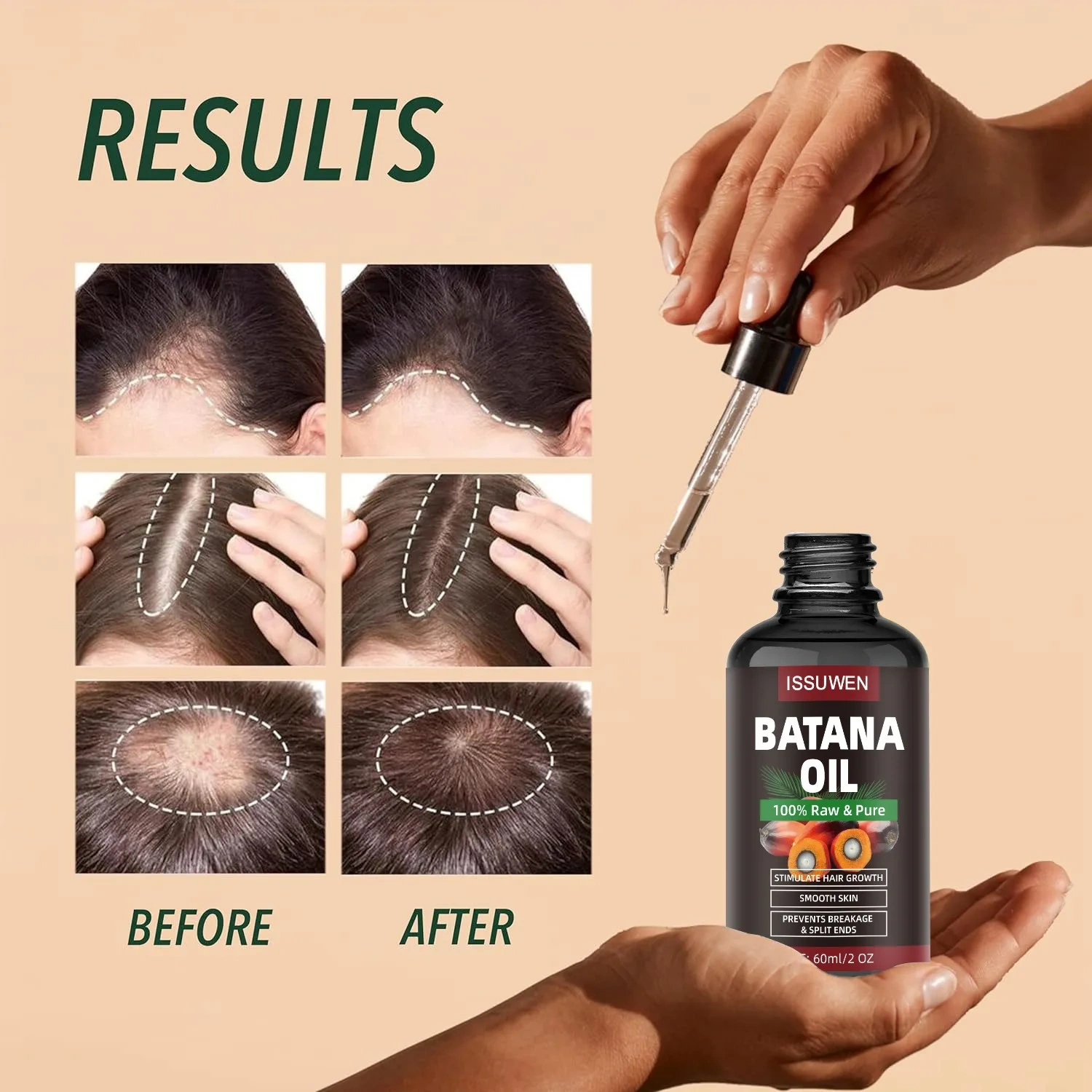 High Quality Organic Hair Care Oil Fast Growing Essential Oil With Light Fragrance for Curly and Dry Hair