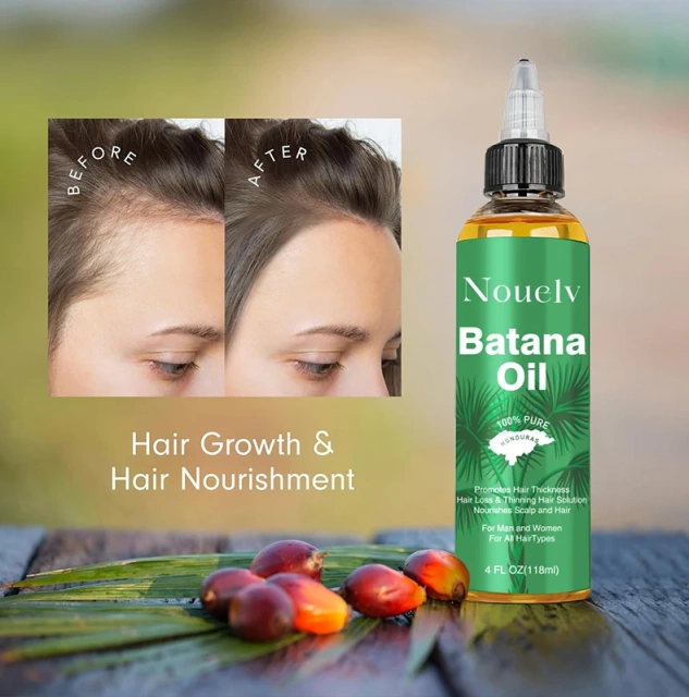 Noue Batana 118ml Hair Oil Beauty & Personal Care Product