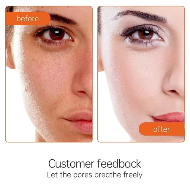 Vitamin C facial whitening cream VC acne papules freckle removal skincare 50ml