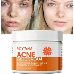 Custom Logo Skin Acne Removal Cream Facial Cream Private Label Natural Acne Face Cream