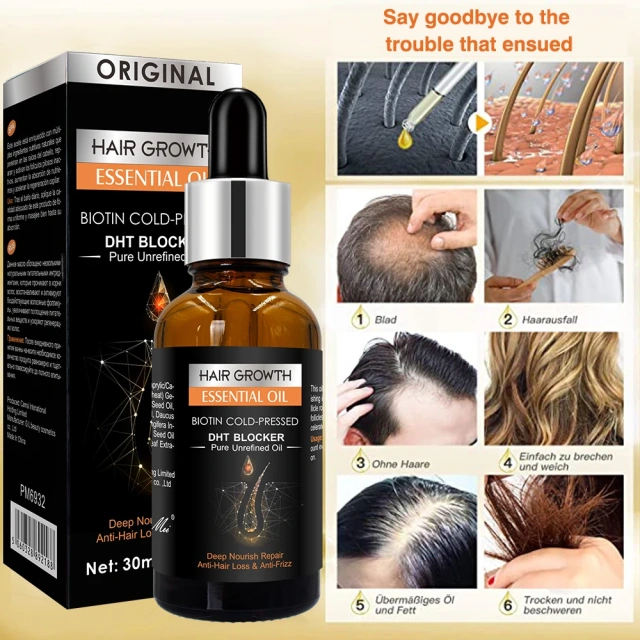 New Original Anti Hair Loss Treatment Fast Hair Growth Serum for Damage Hair