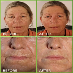 Private Label 2.5% Retinol Collagen Face Cream Retinol Facial Cream with Hyaluronic Acid Night Cream