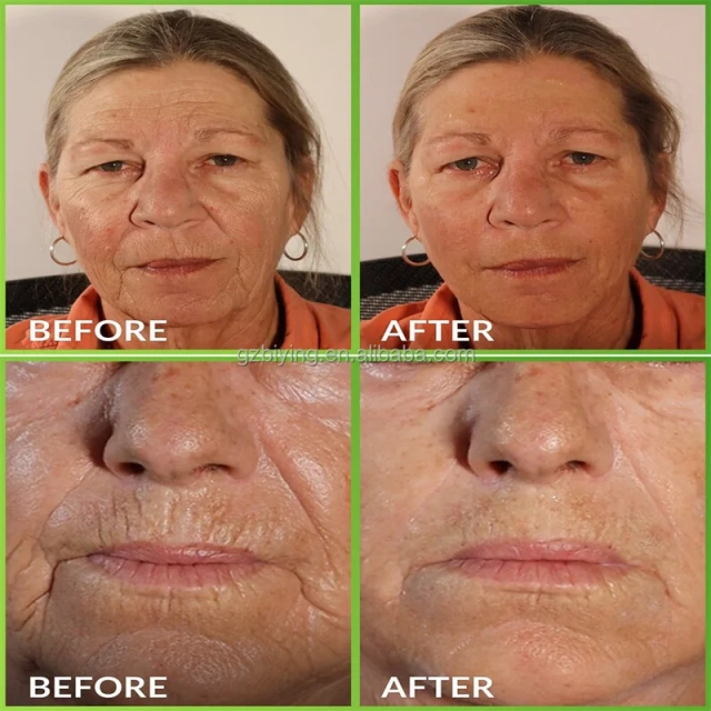 Private Label 2.5% Retinol Collagen Face Cream Retinol Facial Cream with Hyaluronic Acid Night Cream