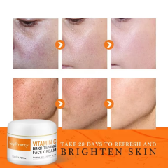 Vitamin C facial whitening cream VC acne papules freckle removal skincare 50ml