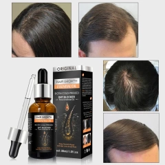 New Original Anti Hair Loss Treatment Fast Hair Growth Serum for Damage Hair