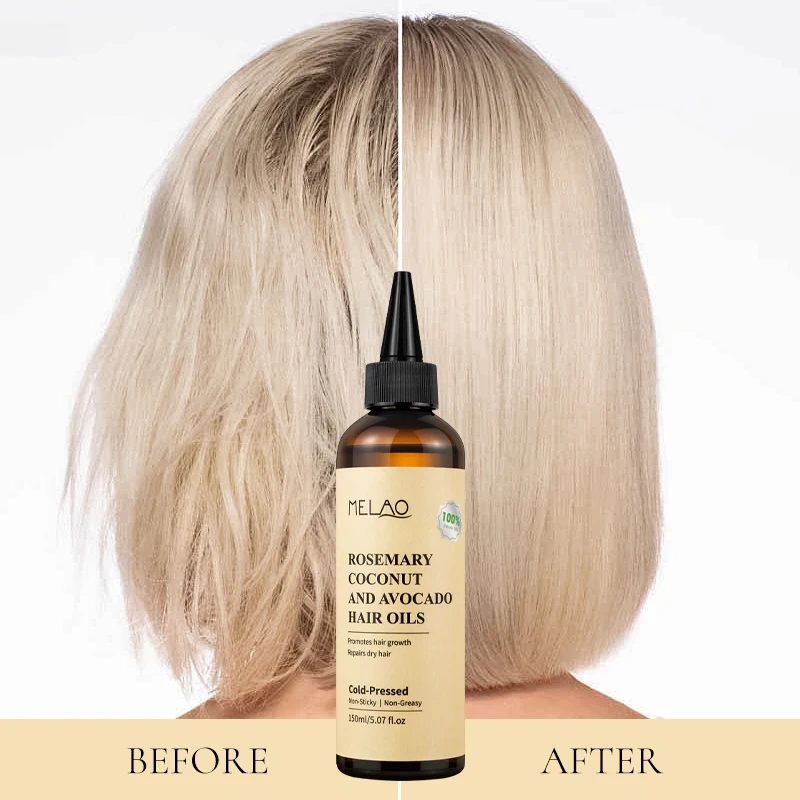 Rosemary Essential Hair Loss Oil Growth Oil Hair Strengthening Dandruff Itchy Deep Rosemary Coconut Avocado Hair Oil